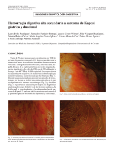 Hemorragia digestiva alta secundaria a sarcoma de Kaposi gástrico