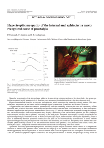 Hypertrophic myopathy of the internal anal sphincter: a rarely