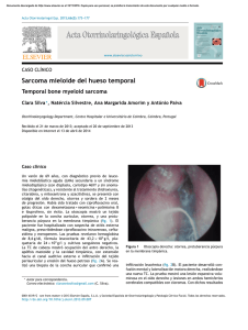 Sarcoma mieloide del hueso temporal