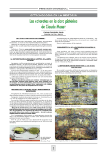 Las cataratas en la obra pictórica de Claude Monet Las cataratas en