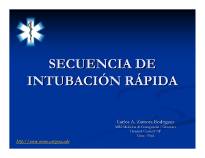 Secuencia Intubacion Rapida