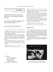Diagnóstico diferencial de calcificación intraescrotal: Litiasis