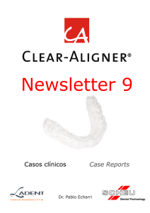 newsletter 9 - Clear Aligner