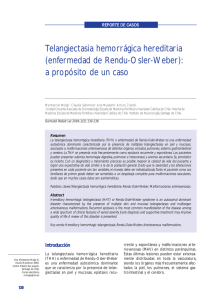 Telangiectasia hemorrágica hereditaria (enfermedad de Rendu