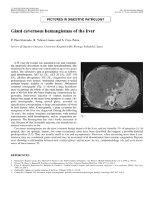 Giant cavernous hemangiomas of the liver
