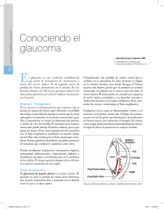 Conociendo el glaucoma