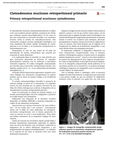 Cistoadenoma mucinoso retroperitoneal primario