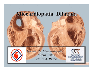 Miocardiopatía Dilatada Ecocardiografía