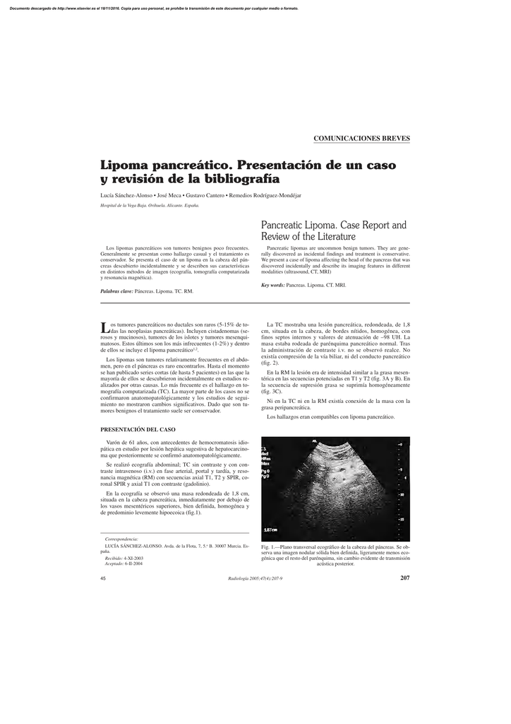 lipoma en cabeza de pancreas lipoma en cabeza de pancreas