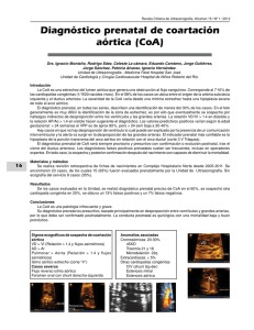 Diagnóstico prenatal de coartación aórtica (CoA)