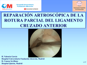 Reparación parcial - Asociación Española de Artroscopia