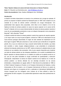 Fijación iridiana sin sutura del lente intraocular en Cámara Posterior.