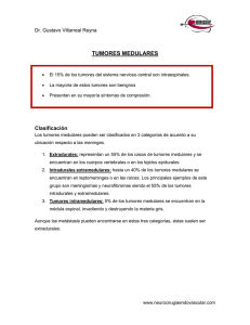 tumores medulares - Neurocirugia Endovascular