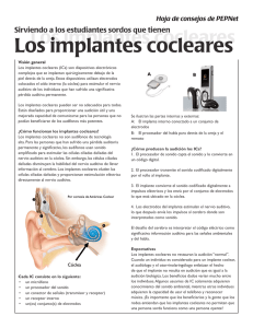 Los implantes cocleares