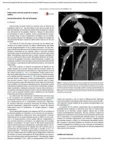 Tuberculosis esternal: papel de la imagen médica Sternal