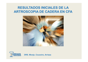 Artroscopia de Cadera en Conflicto Femoro Acetabular