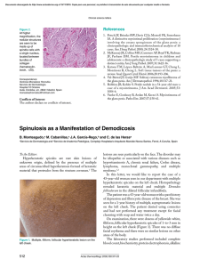Spinulosis as a Manifestation of Demodicosis