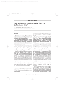 Fracturas de Tibia: Fisiopatolog&iacute;a y Tratamiento
