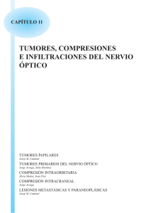tumores, compresiones e infiltraciones del nervio óptico