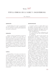 Tema 107 PÁPULA FIBROSA DE LA NARIZ Y