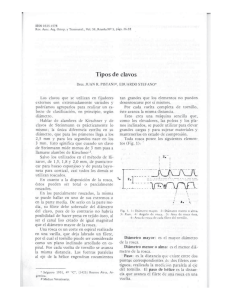 Tipos de clavos