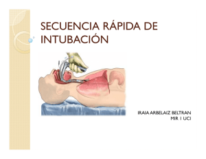 secuencia rápida de intubación