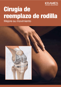 Cirugía de reemplazo de rodilla