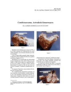 Condrosarcoma: artrodesis fémorosacra