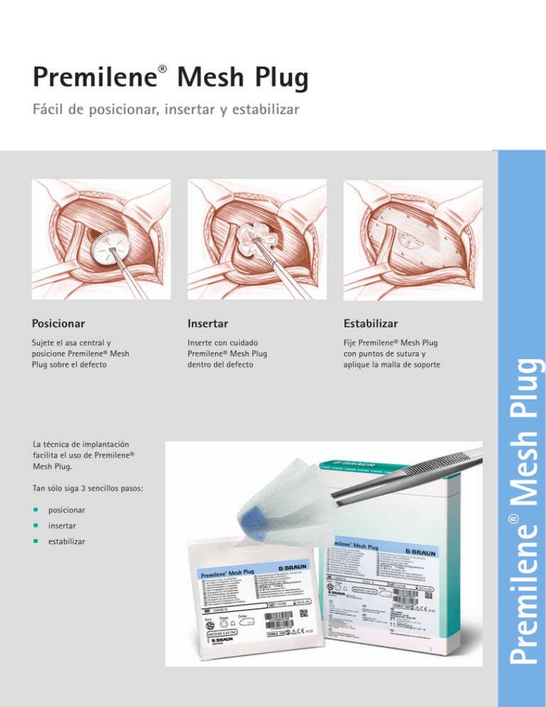 Premilene Mesh Plug