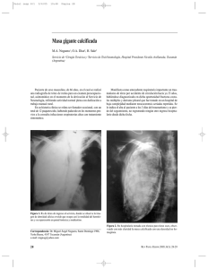 Masa gigante calcificada - Revista de Patología Respiratoria