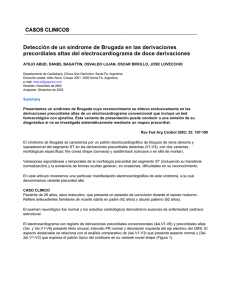 Detección de un síndrome de Brugada en las derivaciones
