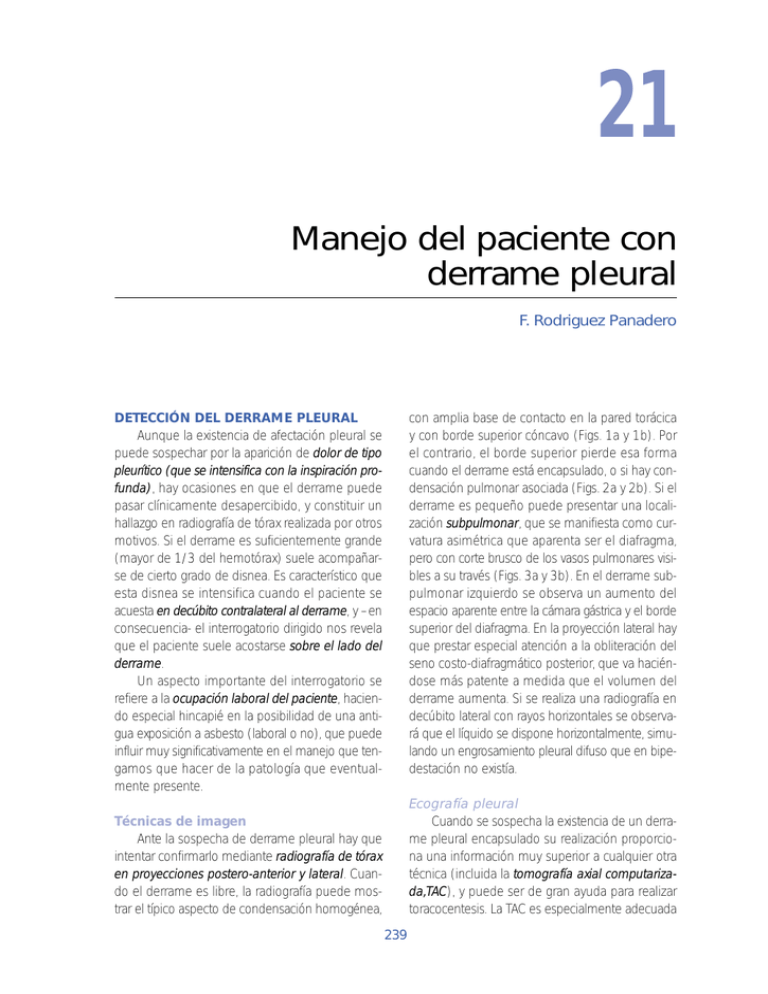 Manejo Del Paciente Con Derrame Pleural