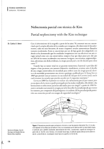 Nefrectomía parcial con técnica de Kim Partial nephrectomy with the