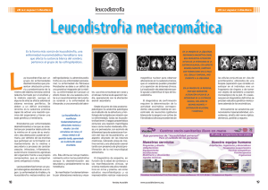 Leucodistrofia metacromática