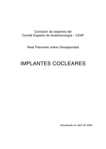 implantes cocleares - Federación de Asociaciones de Implantados