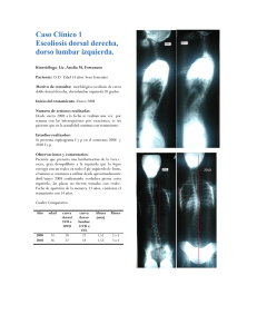 Caso Clínico 1 Escoliosis dorsal derecha, dorso lumbar izquierda.
