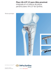 Placa VA-LCP 3.5 Tibia Proximal: T&eacute;cnica Quir&uacute;rgica