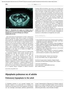 Hipoplasia pulmonar en el adulto