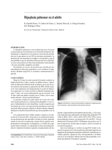 Hipoplasia pulmonar en el adulto - Revista de Patología Respiratoria