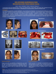 Reconstrucción Facial Con Implantes Hechos a Medida