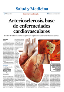 Arteriosclerosis, base de enfermedades cardiovasculares