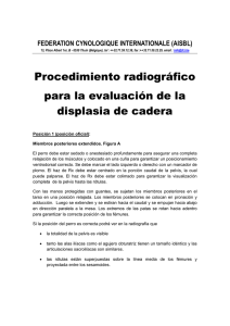 Procedimiento radiográfico para la evaluación de la displasia de
