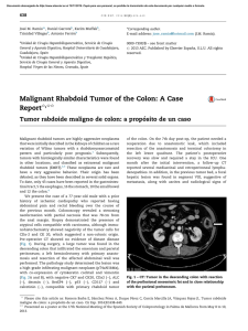 Malignant Rhabdoid Tumor of the Colon: A Case