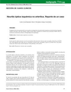 Neuritis óptica isquémica no arterítica. Reporte de