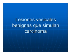 Lesiones vesicales benignas que simulan carcinoma