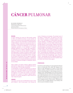 cáncer pulmonar - Clínica Las Condes