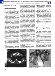 Condrosarcoma de esternón - Archivos de Bronconeumología