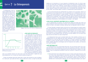 La Osteoporosis - Liga Reumatologica Española (LIRE)