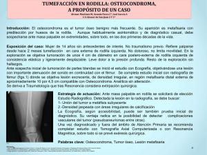 Introducción: El osteocondroma es el tumor óseo benigno más