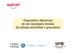 Diagnóstico diferencial de las neoplasias renales de células